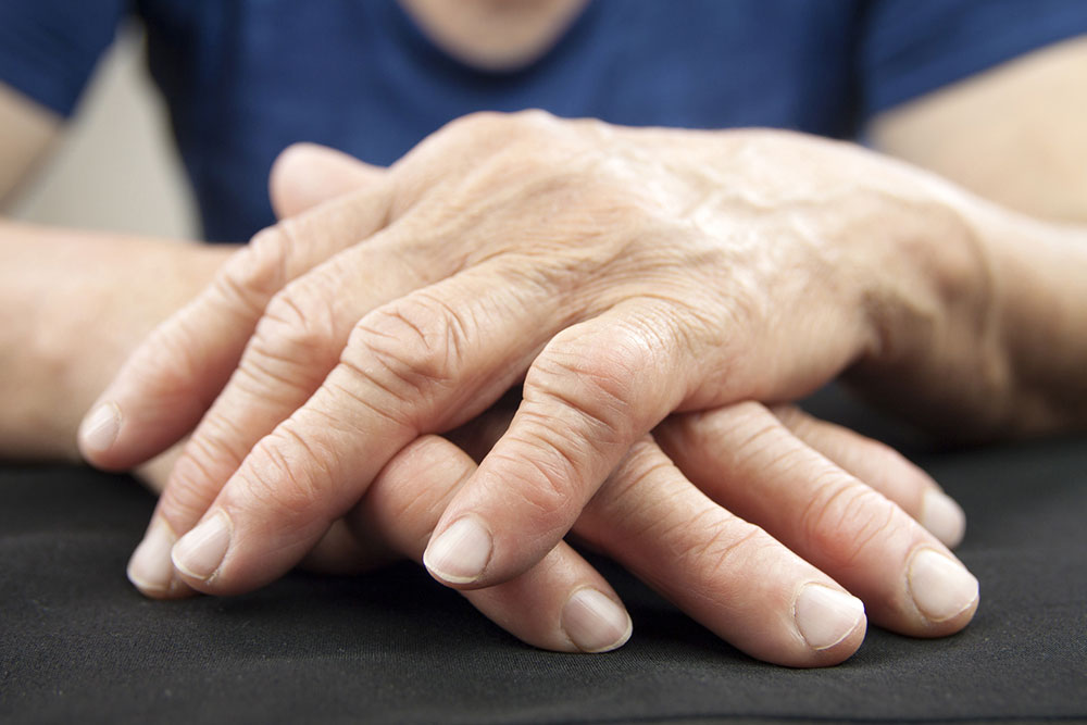 Rheumatoid Arthritis – Diagnosis and Treatment Options